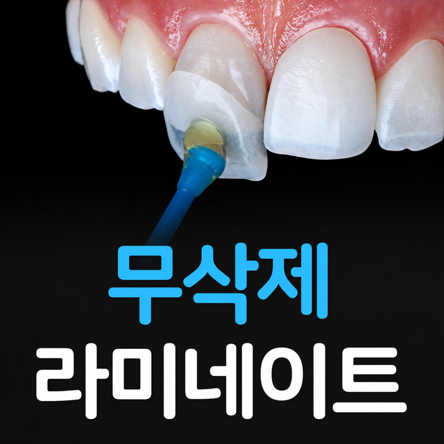 무삭제 라미네이트 자연치아를 보존하고 심미성을 회복시킵니다